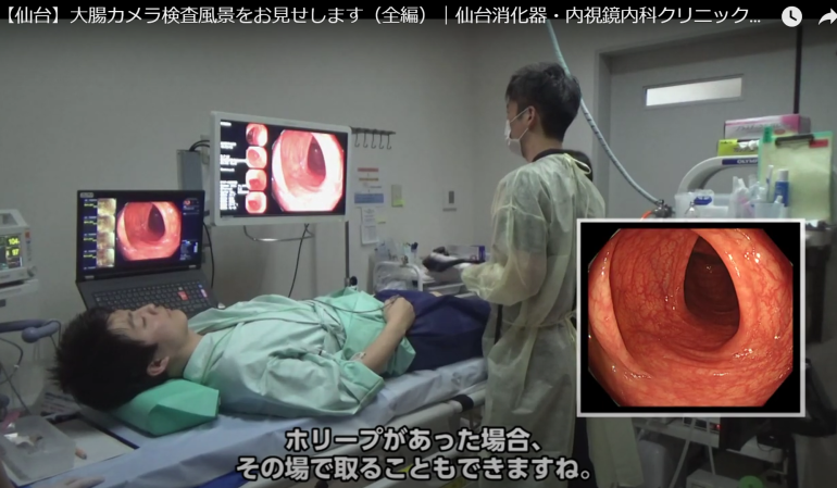 【動画】大腸カメラ検査風景をお見せします～挿入部分のみ編～